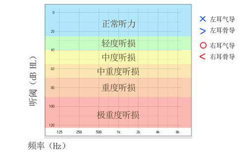 震惊!听力损失10个鲜为人知的事实
